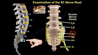 Examination Of S1 Nerve Root  Everything You Need To Know  Dr Nabil Ebraheim [upl. by Ahsemit96]