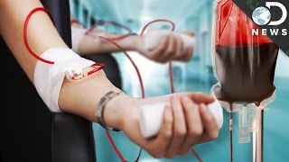 How Do Blood Transfusions Work [upl. by Nnyledam]