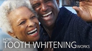 How Tooth Whitening Works [upl. by Nesyla]