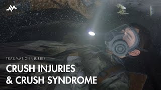 Crush Injury and Crush Syndrome  The Last of Us [upl. by Silecara]