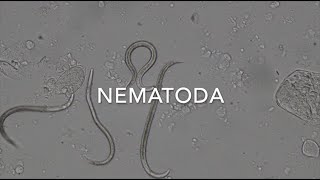 Nematodes [upl. by Yale]