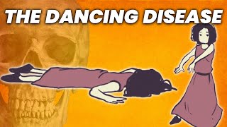 The Disease That Made People Die from Dancing [upl. by Anicart]