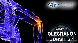 Heel Bursitis  Causes and Treatment [upl. by Teilo73]