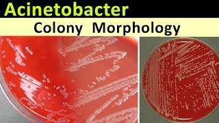 Acinetobacter Colony Morphology [upl. by Ailemaj]