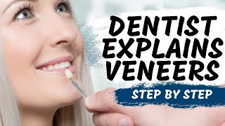 Porcelain Veneers Procedure Explained [upl. by Ataner]