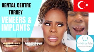 I HAD MY TEETH DONE IN TURKEY PART 1  DENTAL CENTRE TURKEY  Hollywood Smile Makeover  Veneers [upl. by Noll]