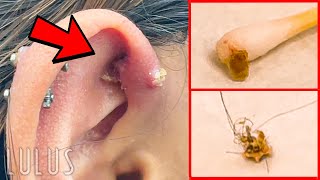 CLEAN Your Piercings Or THIS Can Happen…REMOVAL [upl. by Sinai]