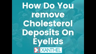 How Do You Remove Cholesterol Deposits On Eyelids   By XANTHEL ® Easy Xanthelasma Removal [upl. by Papagena312]