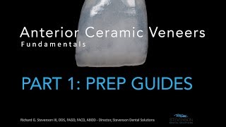 Anterior Ceramic Veneers Part 1 Preparation Guides [upl. by Mabel632]