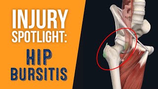 Exercises and Stretches for Hip Bursitis [upl. by Childs]