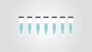 Tips and tricks Phospho Western Blots [upl. by Ennylhsa]