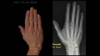 Anatomy of Hand XraysRevised [upl. by Blainey]