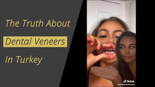 The Truth about Dental Veneers in Turkey [upl. by Lleret]