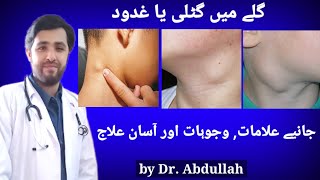 Swollen Lymph Nodes In Neck Symptoms Causes amp Treatment  Lymphadenopathy  Gale Ki Gilti Ya Ganth [upl. by Cardie]