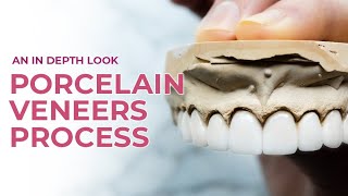 Porcelain Veneers A Dental Boutique Process  An In Depth Look [upl. by Mada]