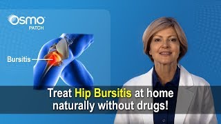 Knee Bursitis  Everything You Need To Know  Dr Nabil Ebraheim [upl. by Hodess698]