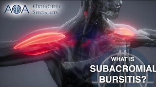 What is Shoulder Bursitis [upl. by Shedd485]