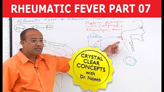 Rheumatic Fever amp Heart Disease Part 77 [upl. by Strawn]