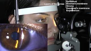 Ophthalmic Skills Series Part 15 [upl. by Yamauchi]