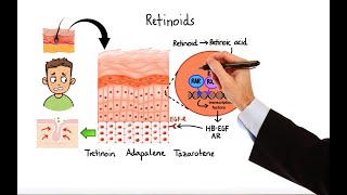 Pharmacology  ACNE TREATMENTS MADE EASY [upl. by Assirek]